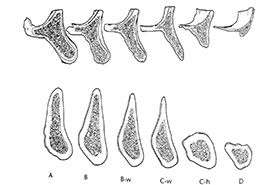 Fig.1 - Cycle de résorption de l'os alvéolaire au maxillaire et à la mandibule.